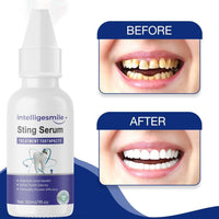 Intelligesmile Sting Serum Treatment Toothpaste 30ml Pack of 1 - Faydekasauda