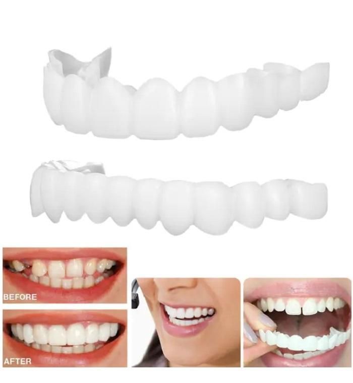 Teeth Brace Temporary Teeth Braces Cover - Faydekasauda