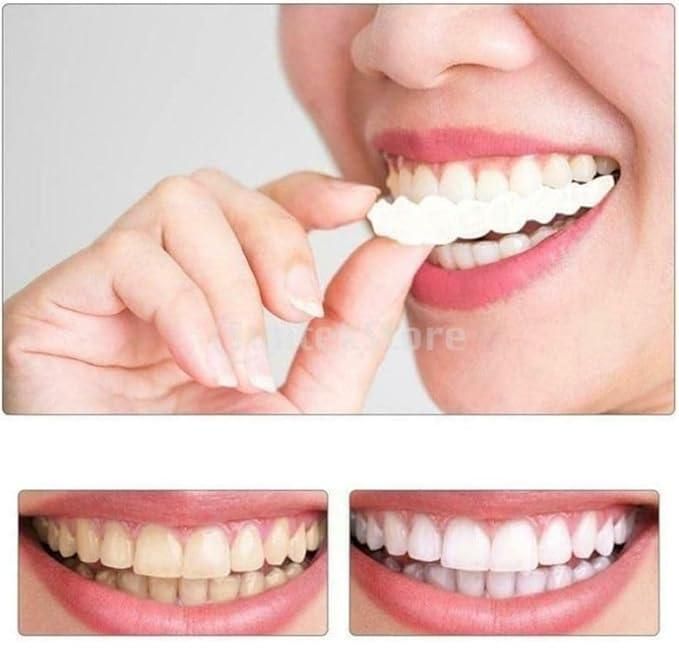 Teeth Brace Temporary Teeth Braces Cover - Faydekasauda