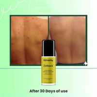 Afnemy Zidback Body Spray 100ML (Pack of 2) - Faydekasauda