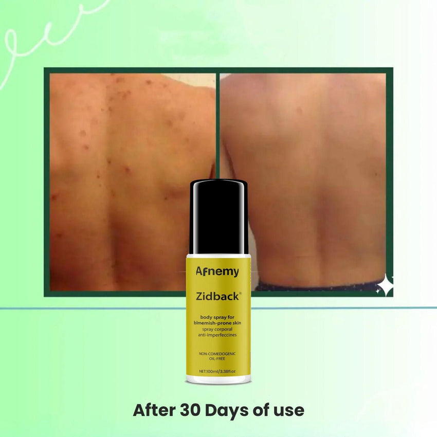Afnemy Zidback Body Spray 100ML (Pack of 2) - Faydekasauda