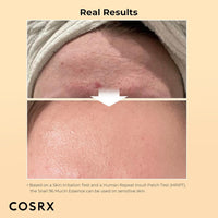 Snail 96 Mucin Power Essence 100 Ml Each  Pack of 2